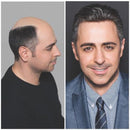 Próteses Masculina HD